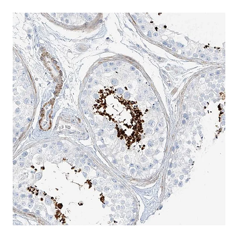 Atlas Antibodies Anti-SMCP Antibody