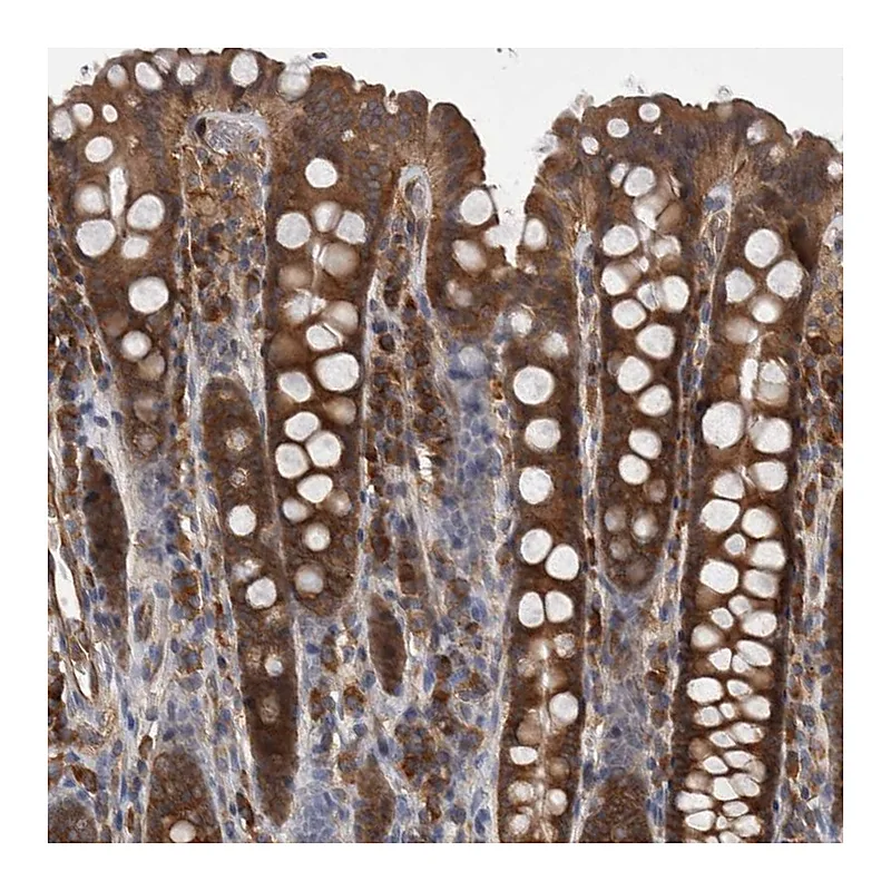 Atlas Antibodies Anti-SMCR8 Antibody