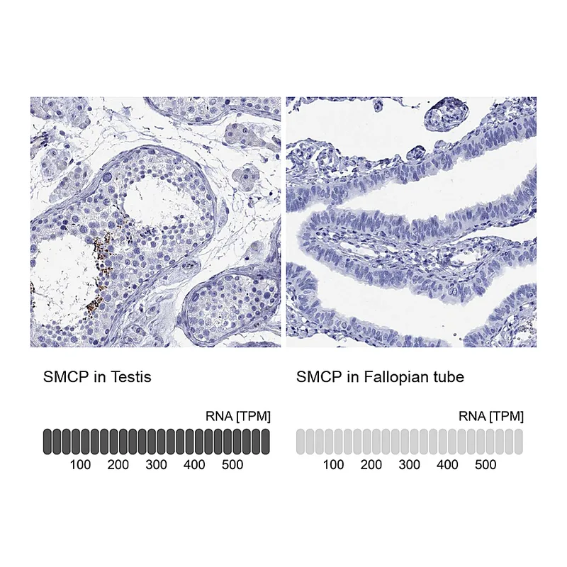 Atlas Antibodies Anti-SMCP Antibody