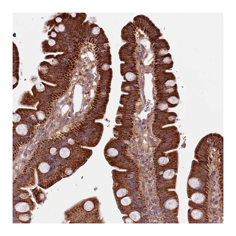 Atlas Antibodies Anti-SMG1 Antibody