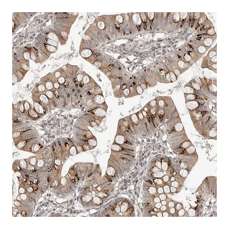 Atlas Antibodies Anti-SMG8 Antibody
