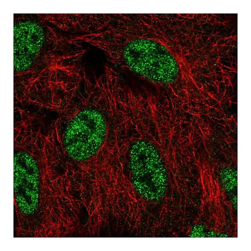 Atlas Antibodies Anti-SMG1 Antibody