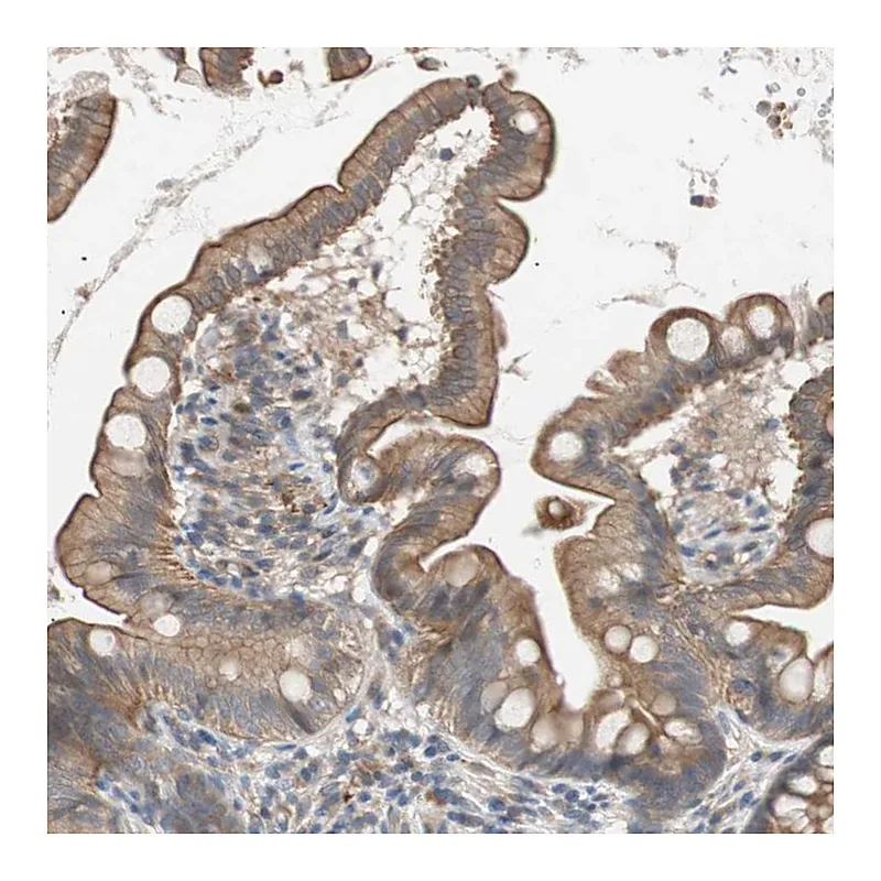 Atlas Antibodies Anti-SMG1 Antibody