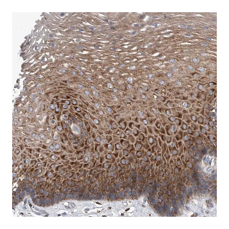 Atlas Antibodies Anti-SMG7 Antibody