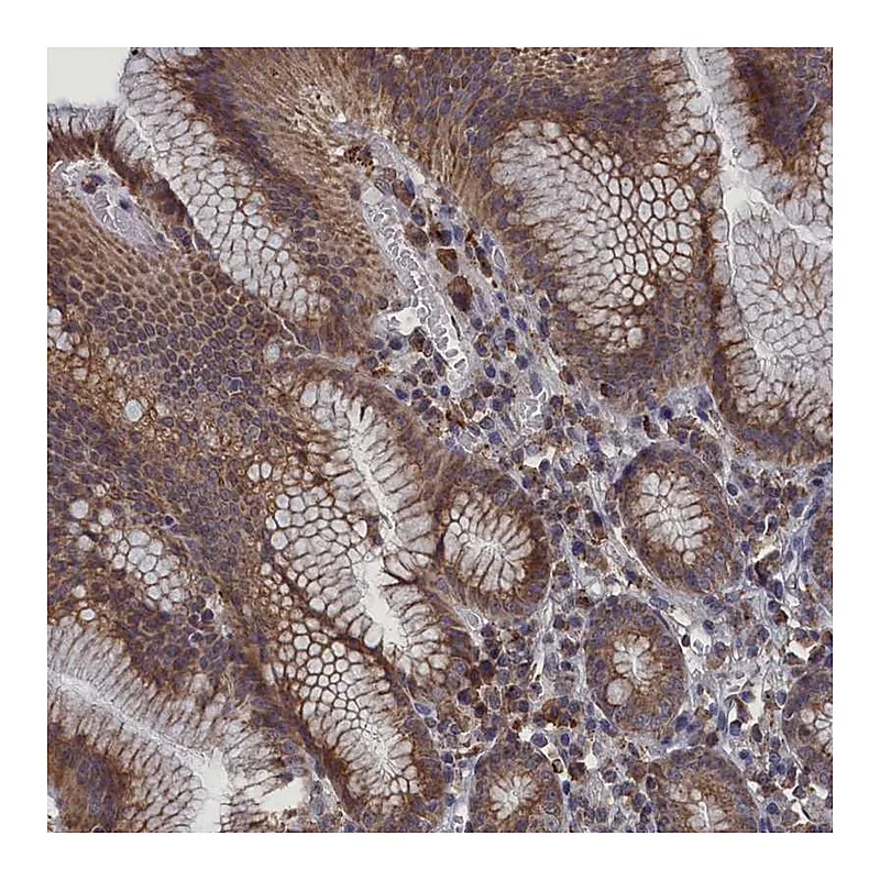 Atlas Antibodies Anti-SMG9 Antibody