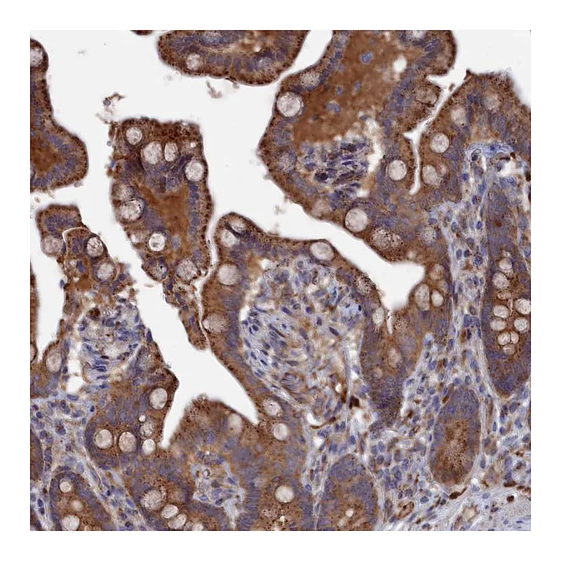 Atlas Antibodies Anti-SMG9 Antibody