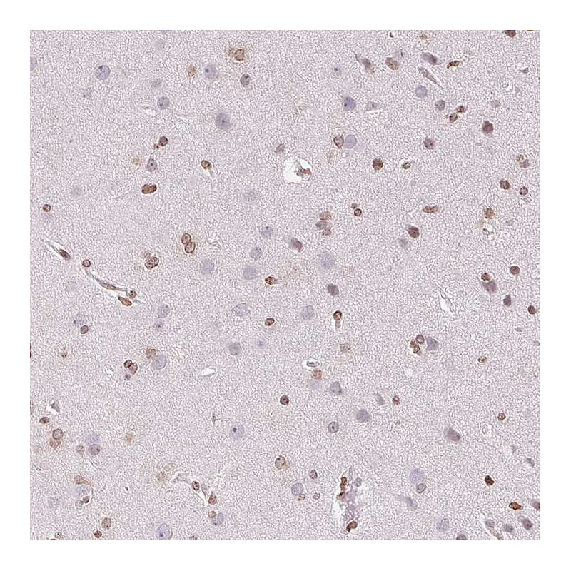 Atlas Antibodies Anti-SMIM12 Antibody