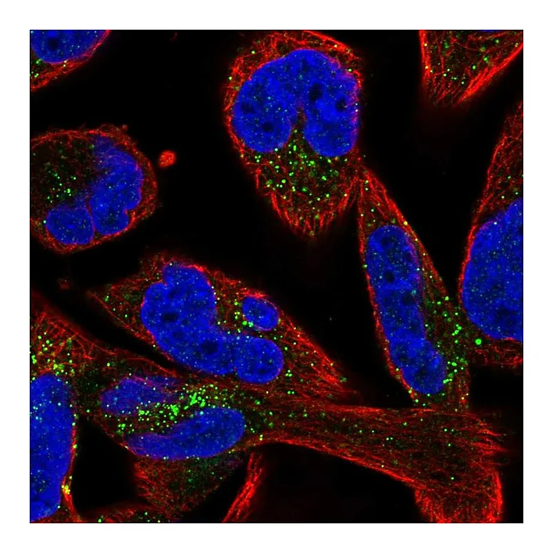 Atlas Antibodies Anti-SMIM17 Antibody