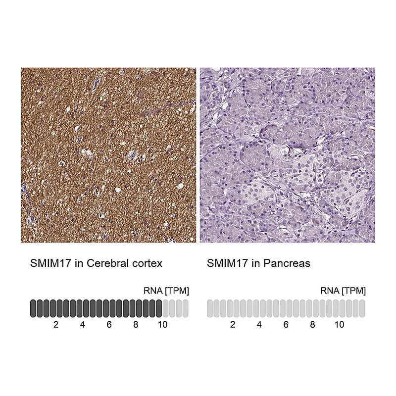 Atlas Antibodies Anti-SMIM17 Antibody