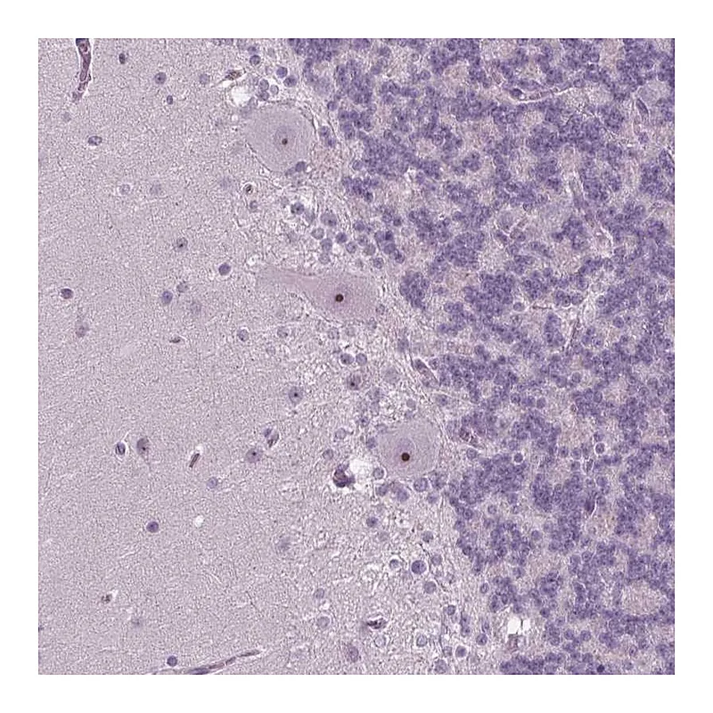 Atlas Antibodies Anti-SMIM18 Antibody