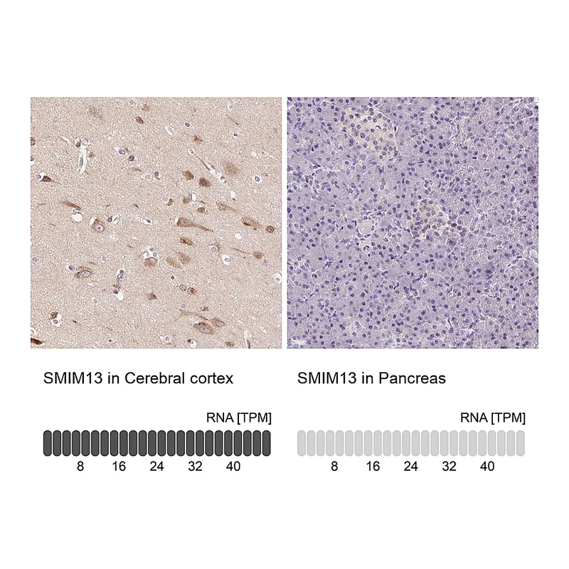 Atlas Antibodies Anti-SMIM13 Antibody