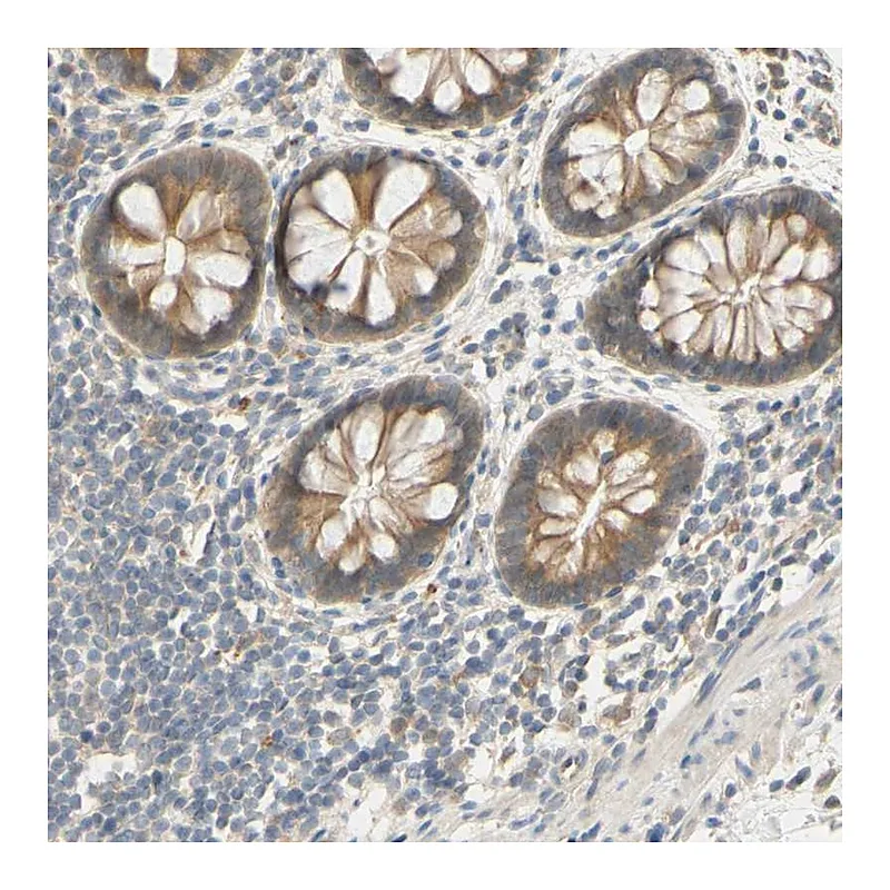 Atlas Antibodies Anti-SMIM19 Antibody