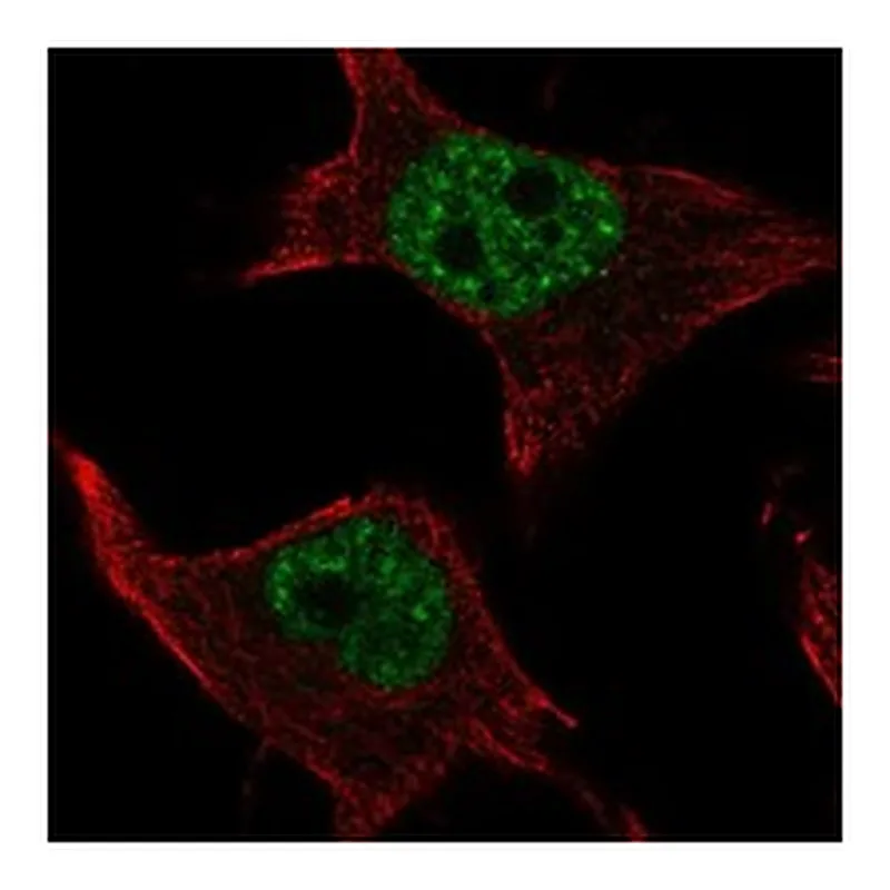 Atlas Antibodies Anti-SMIM19 Antibody