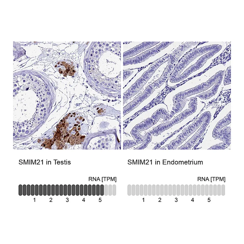 Atlas Antibodies Anti-SMIM21 Antibody