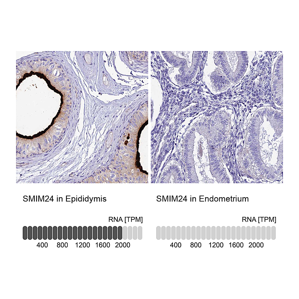 Atlas Antibodies Anti-SMIM24 Antibody