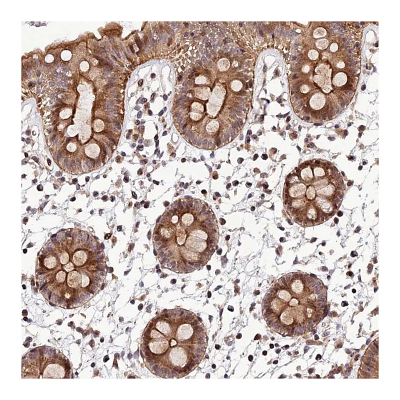 Atlas Antibodies Anti-SMIM7 Antibody