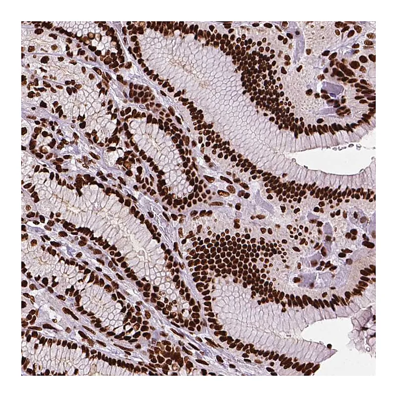 Atlas Antibodies Anti-SMIM5 Antibody