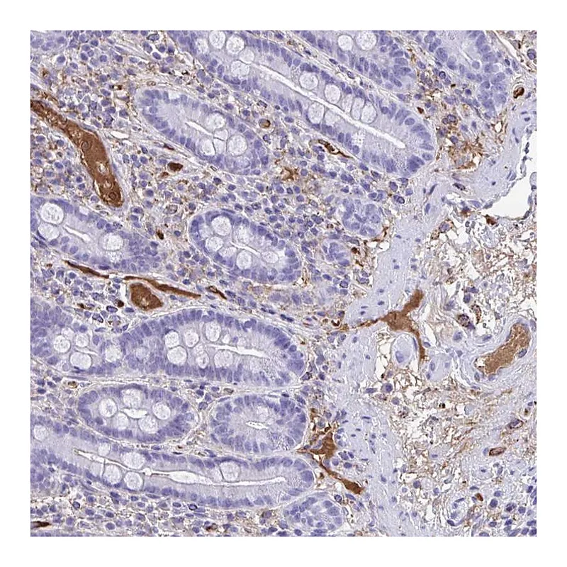 Atlas Antibodies Anti-SMIM9 Antibody