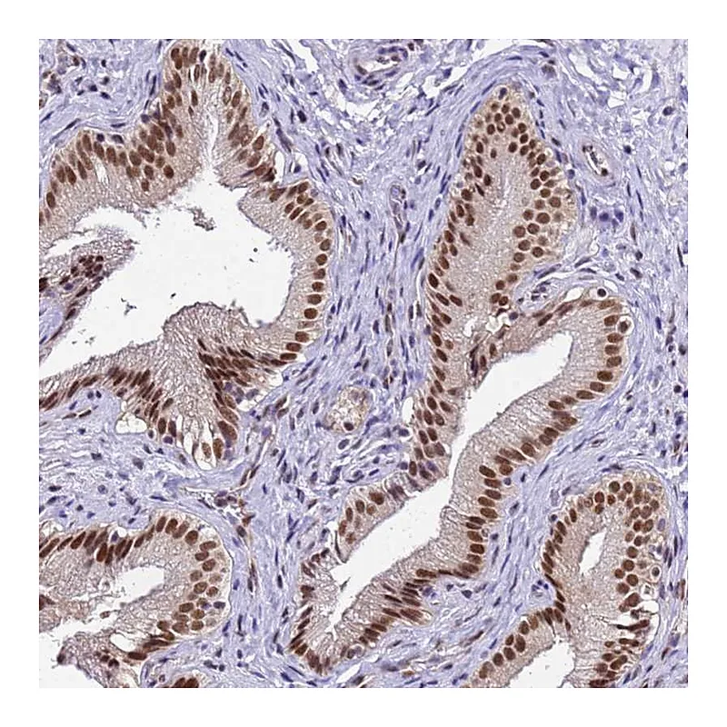 Atlas Antibodies Anti-SMN1 Antibody