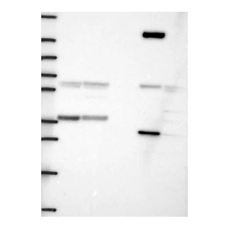 Atlas Antibodies Anti-SMN1 Antibody