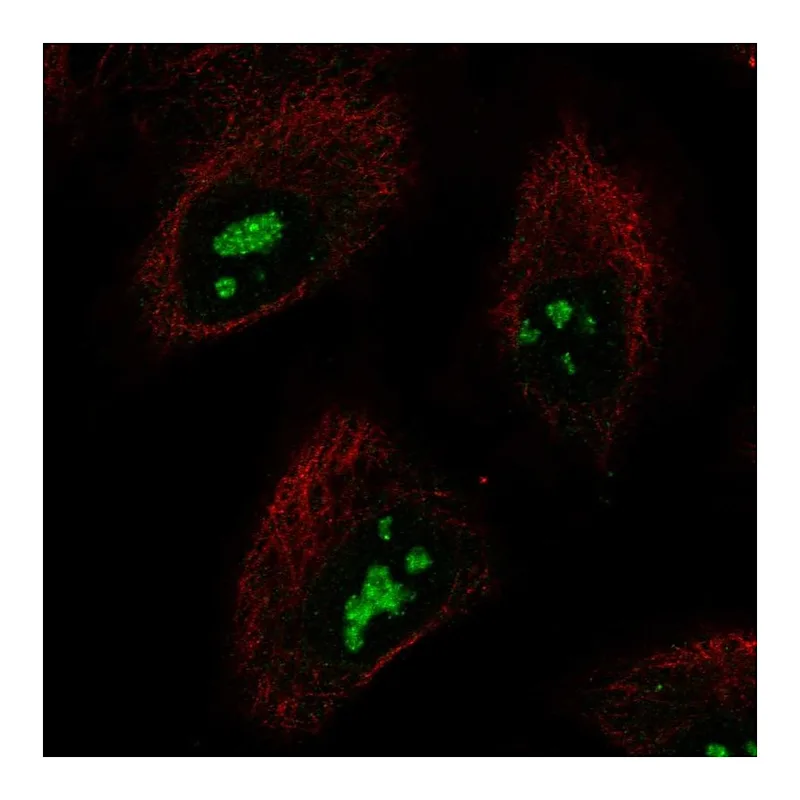Atlas Antibodies Anti-SMKR1 Antibody