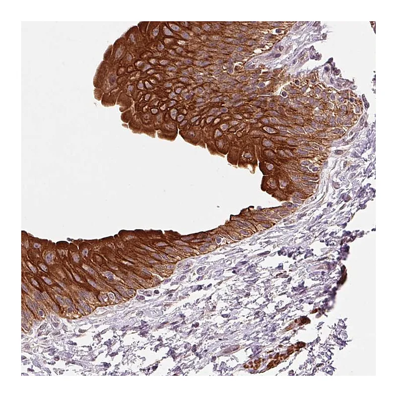 Atlas Antibodies Anti-SMLR1 Antibody