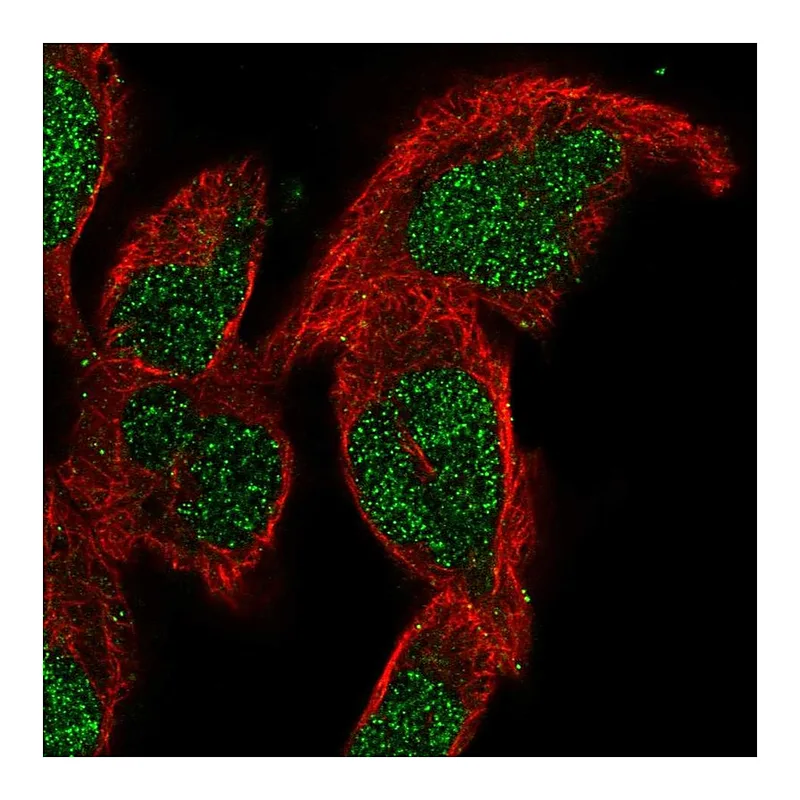 Atlas Antibodies Anti-SMNDC1 Antibody