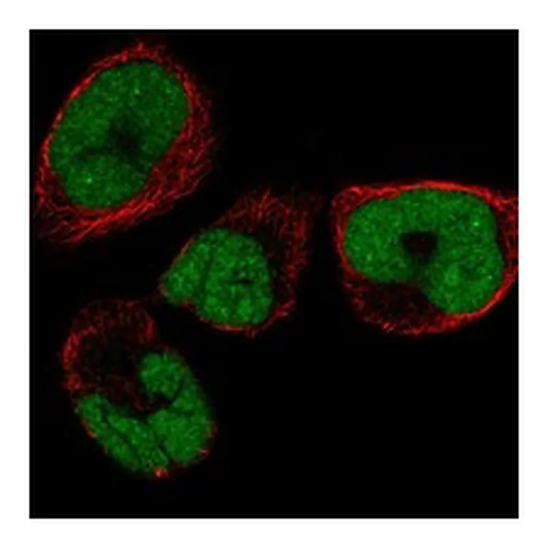 Atlas Antibodies Anti-SMNDC1 Antibody