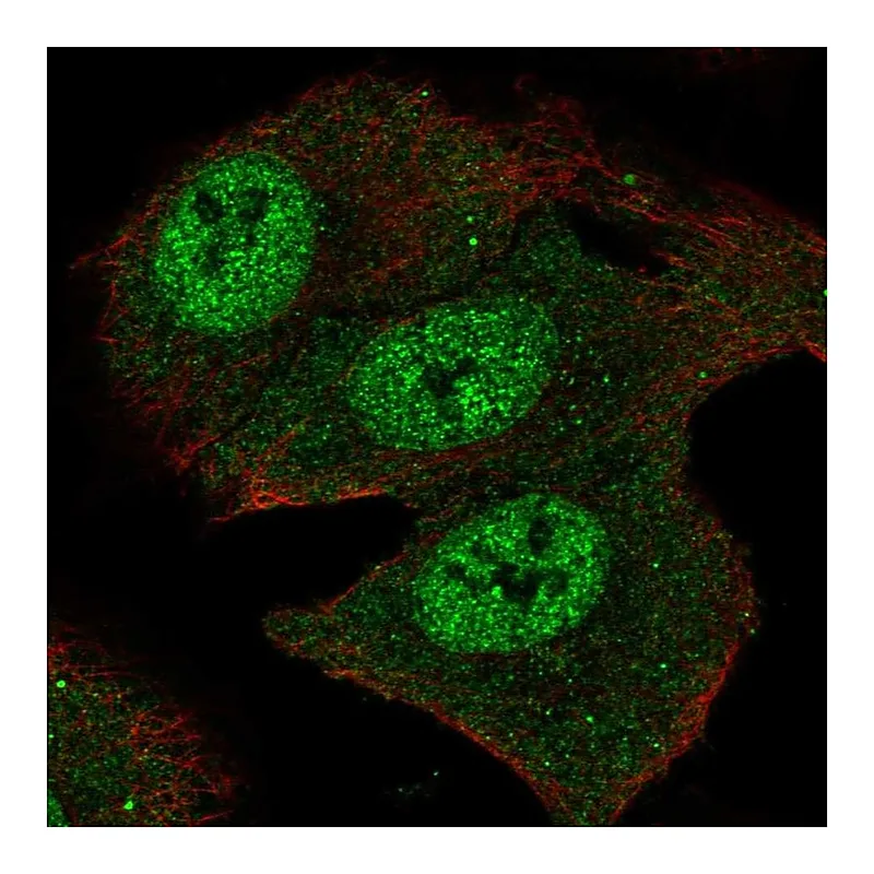 Atlas Antibodies Anti-SMOX Antibody