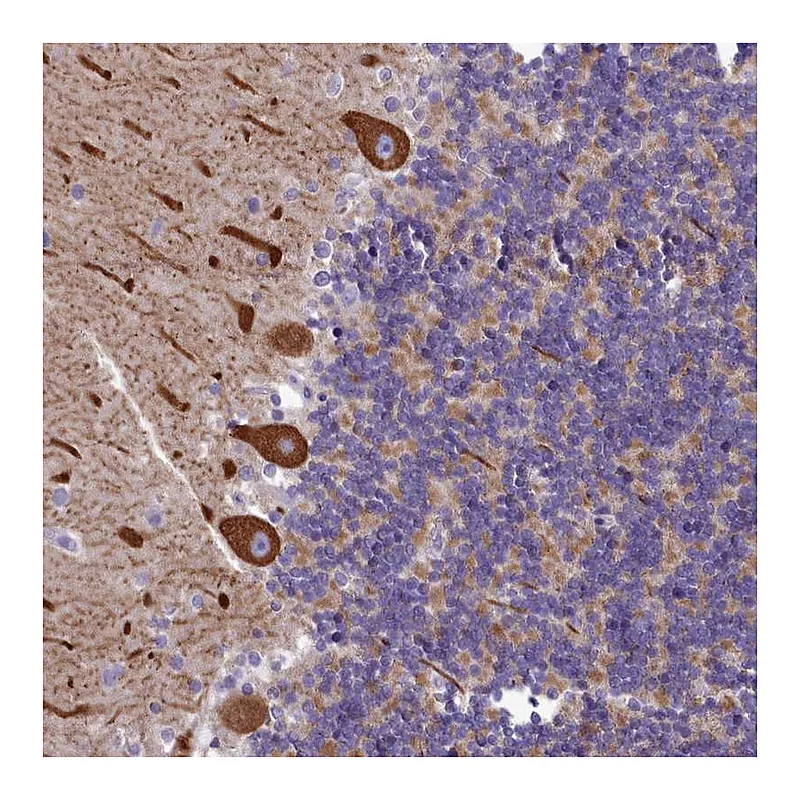 Atlas Antibodies Anti-SMPD4 Antibody