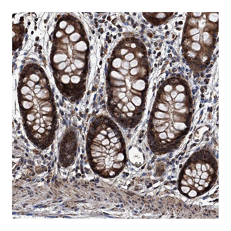 Atlas Antibodies Anti-SMPDL3A Antibody