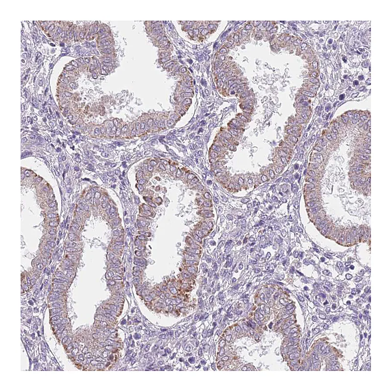 Atlas Antibodies Anti-SMPD4 Antibody