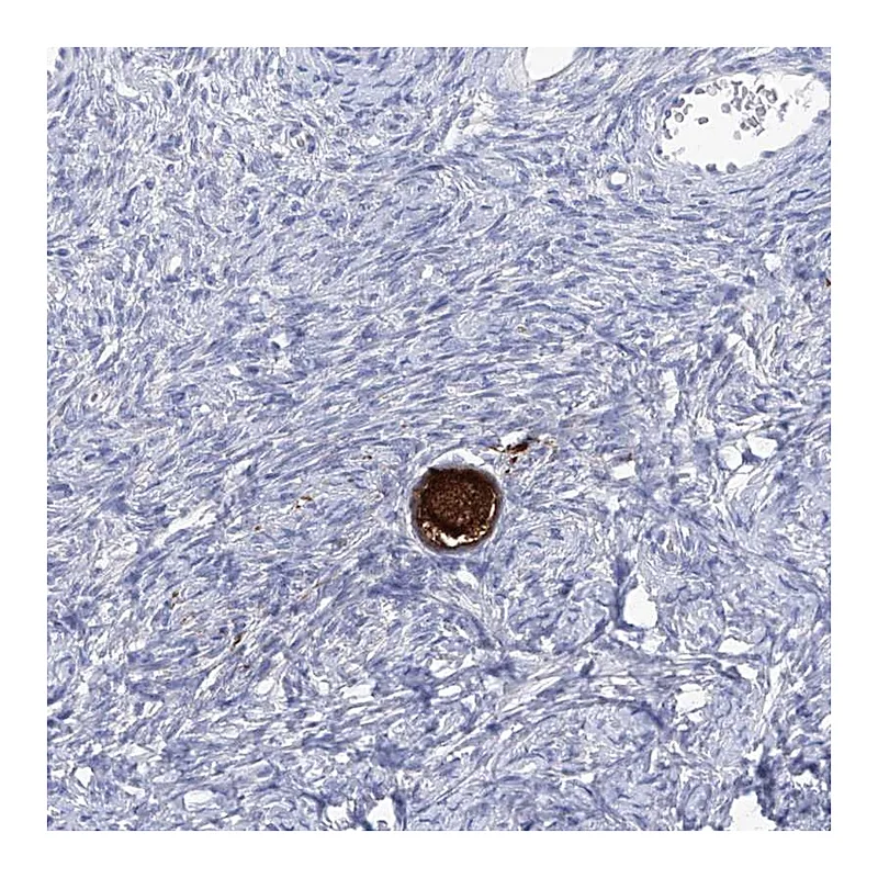 Atlas Antibodies Anti-SMS Antibody