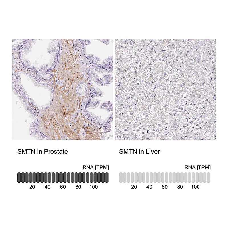 Atlas Antibodies Anti-SMTN Antibody