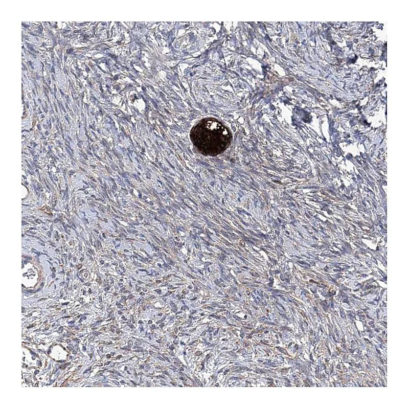 Atlas Antibodies Anti-SMS Antibody