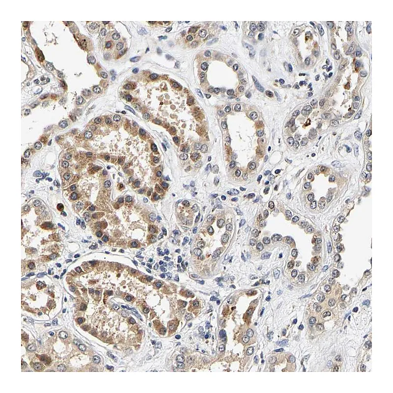 Atlas Antibodies Anti-SMU1 Antibody