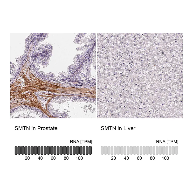 Atlas Antibodies Anti-SMTN Antibody