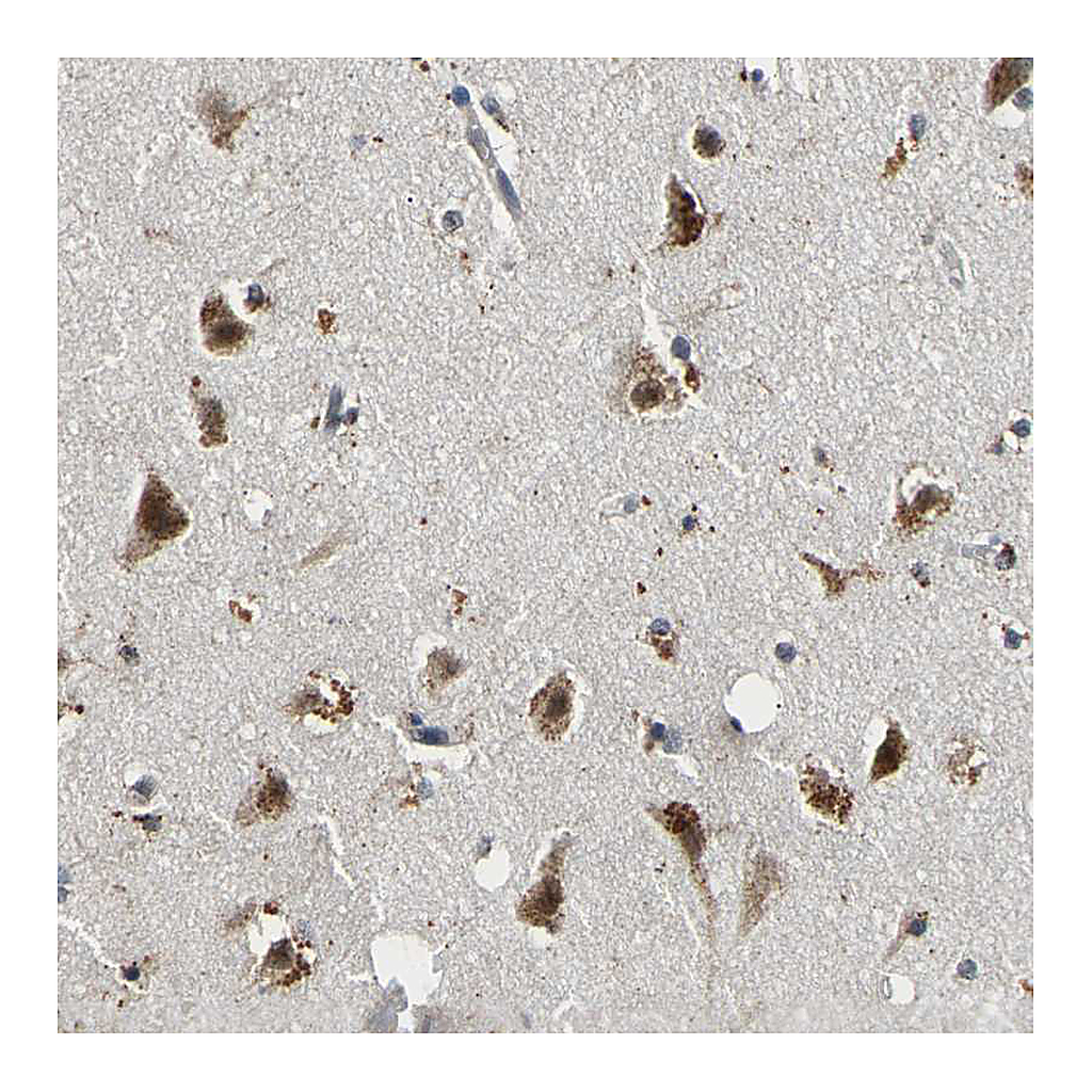 Atlas Antibodies Anti-SMU1 Antibody