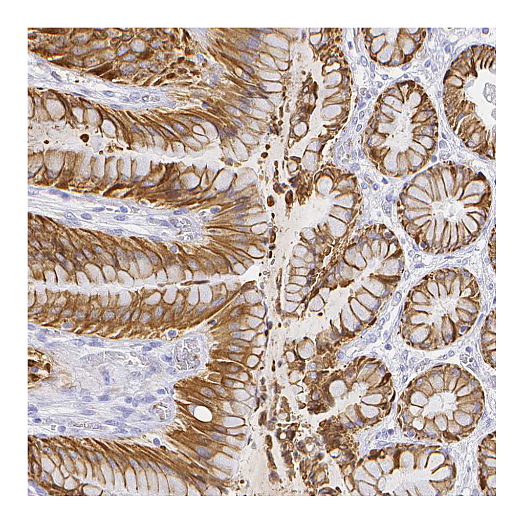 Atlas Antibodies Anti-SMURF1 Antibody