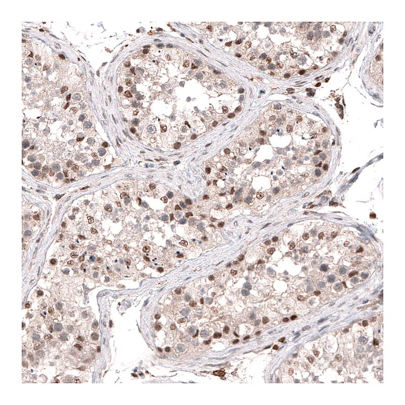 Atlas Antibodies Anti-SMYD2 Antibody