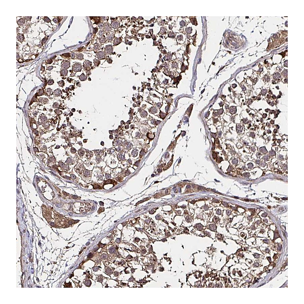 Atlas Antibodies Anti-SMYD3 Antibody