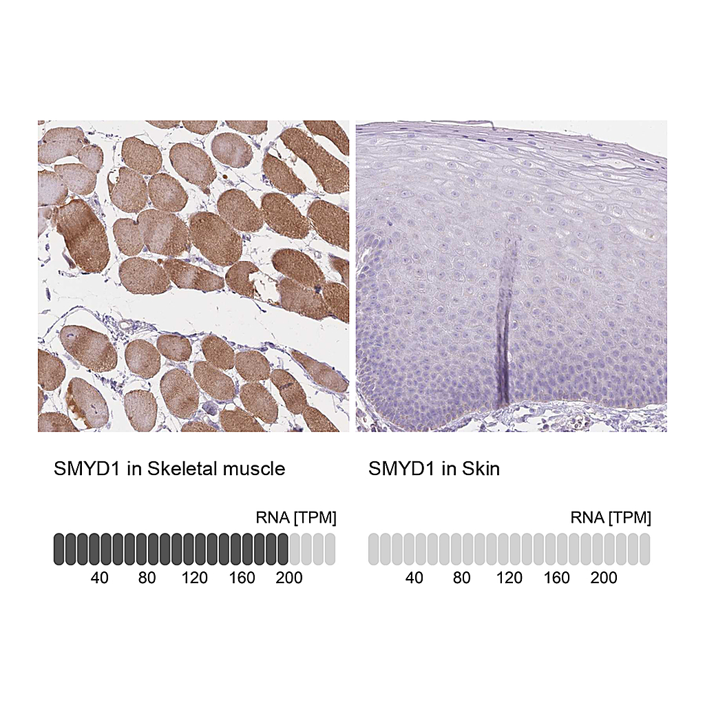 Atlas Antibodies Anti-SMYD1 Antibody
