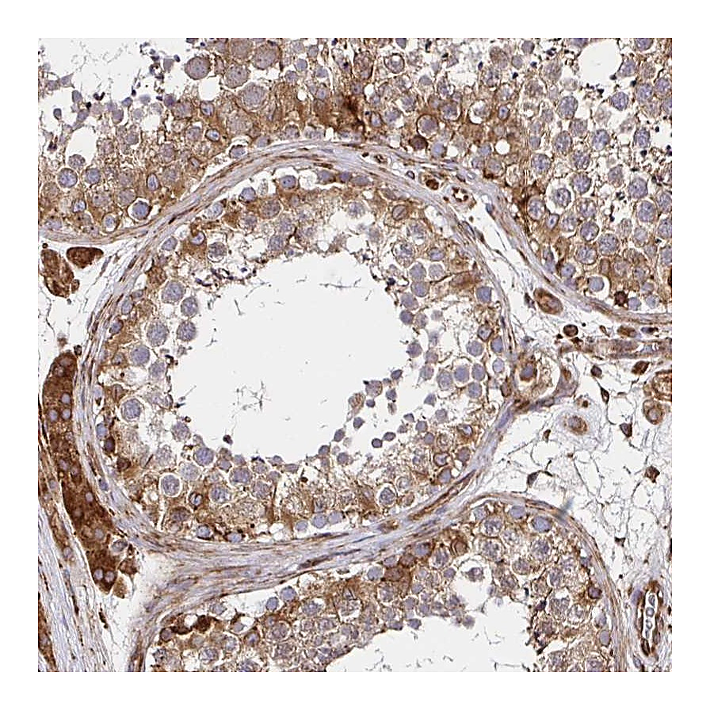 Atlas Antibodies Anti-SMYD3 Antibody