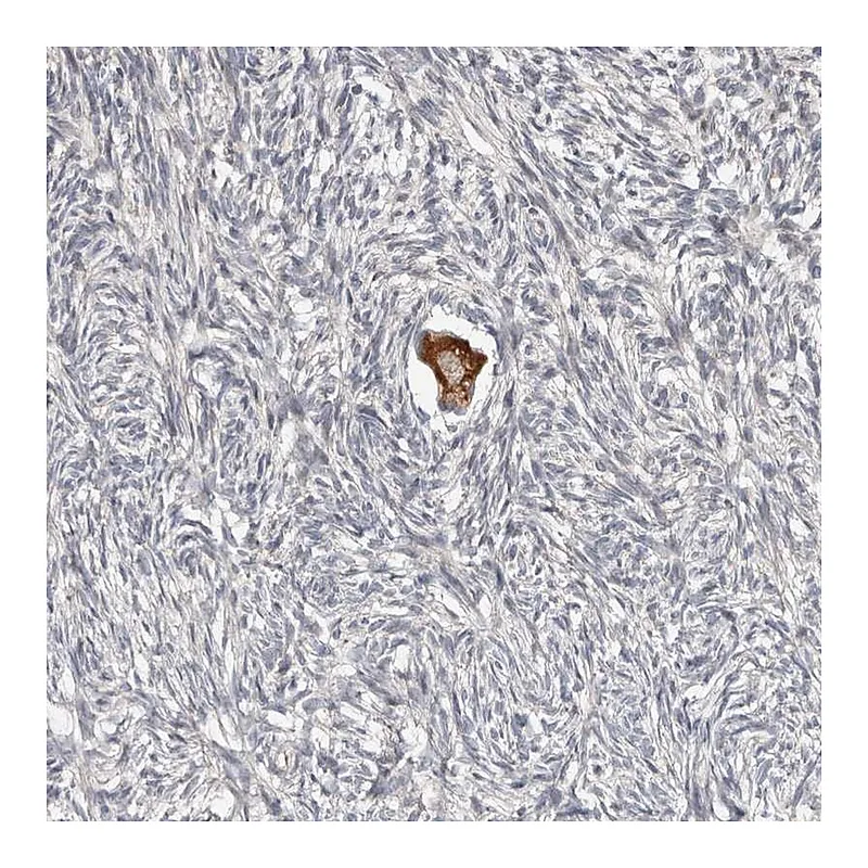 Atlas Antibodies Anti-SMYD4 Antibody