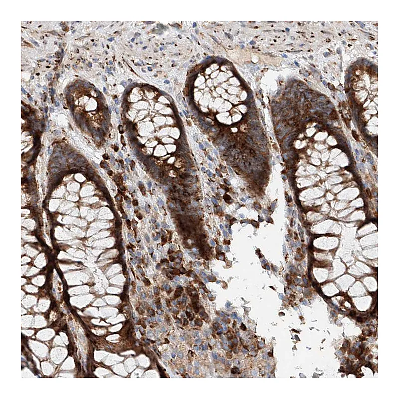Atlas Antibodies Anti-SNAP29 Antibody
