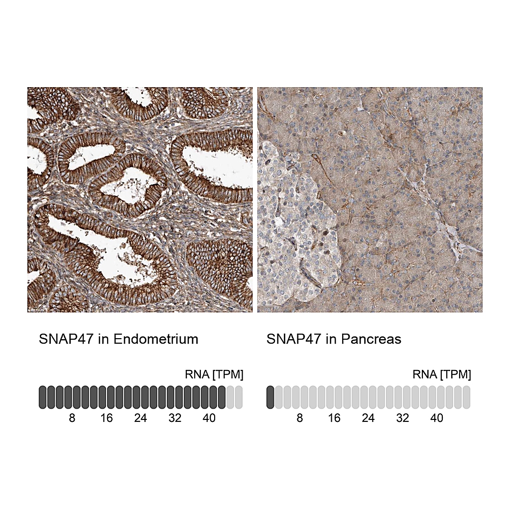 Atlas Antibodies Anti-SNAP47 Antibody