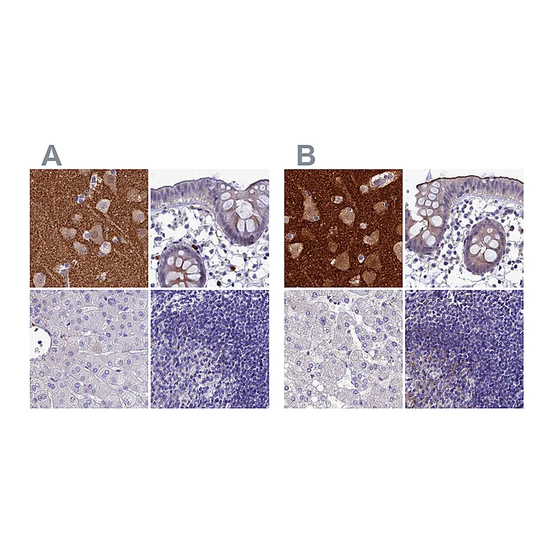 Atlas Antibodies Anti-SNAP91 Antibody