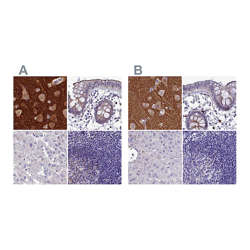 Atlas Antibodies Anti-SNAP91 Antibody