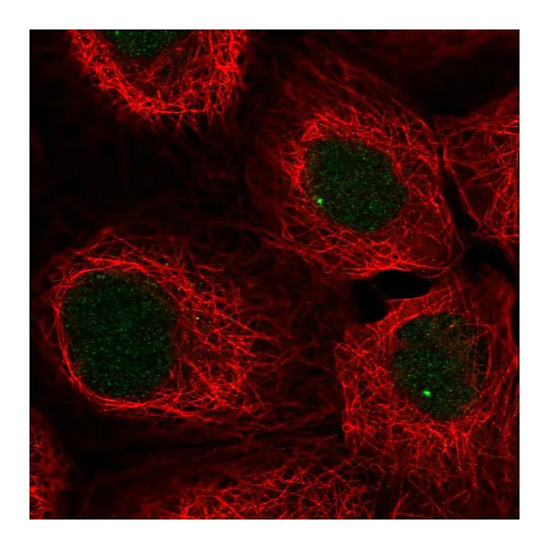 Atlas Antibodies Anti-SNAPC3 Antibody