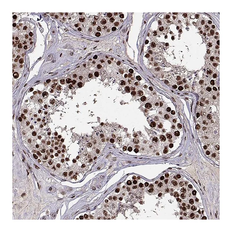 Atlas Antibodies Anti-SNAPC2 Antibody